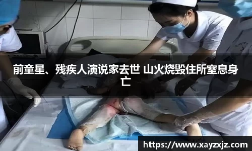 PG国际前童星、残疾人演说家去世 山火烧毁住所窒息身亡